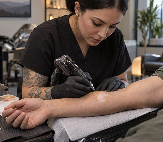 Does vitiligo camouflage tattooing hurt more than a standard tattoo